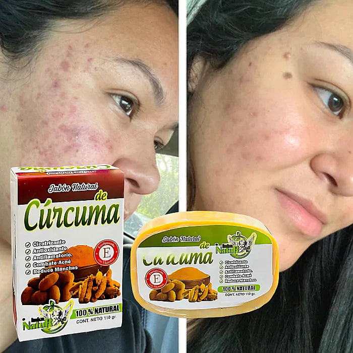 JABON DE CURCUMA- Elimina imperfecciones