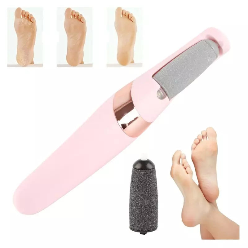 ✨Removedor de Callos Profesional✨ – ¡Pies suaves en minutos! PREMIUM